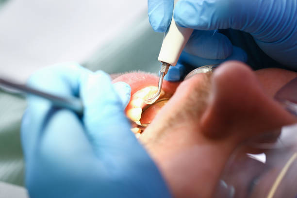 Best Emergency Cosmetic Dentistry (e.g., broken veneers) in Laguna Park, TX