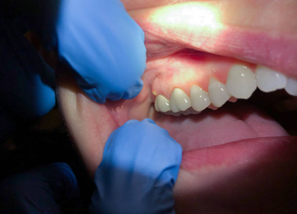 Best After-Hours Dental Care in Laguna Park, TX